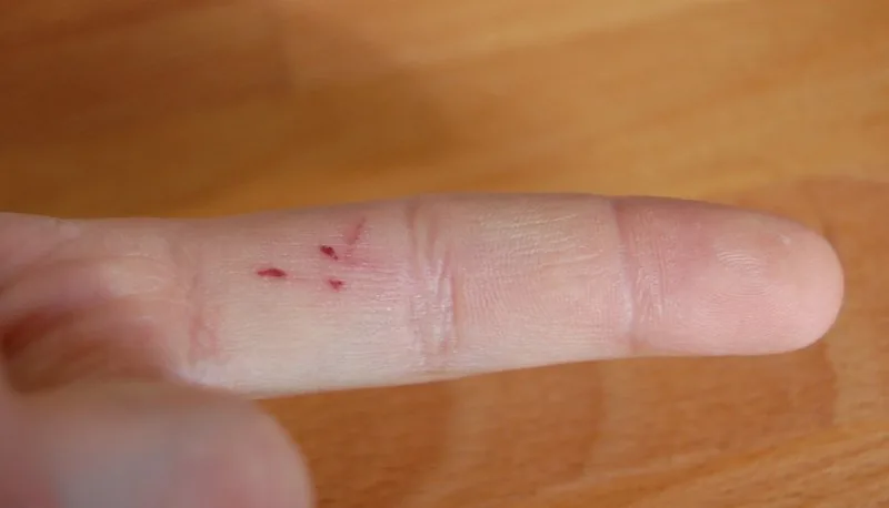 finger.jpg